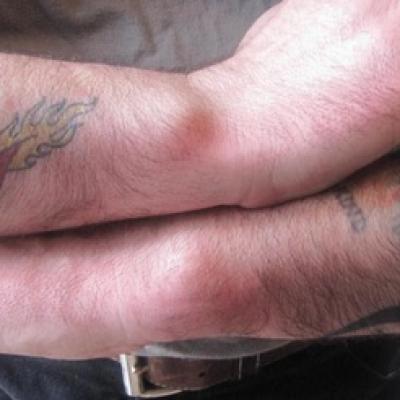 Wrist Conditioning